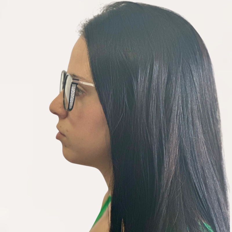 Crystal Elite Vision – Multifocal Glasses with Free Gifts